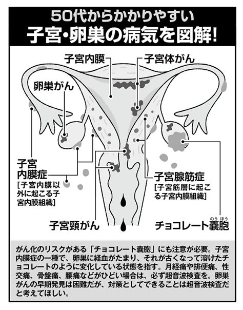 風水 子宮の病気